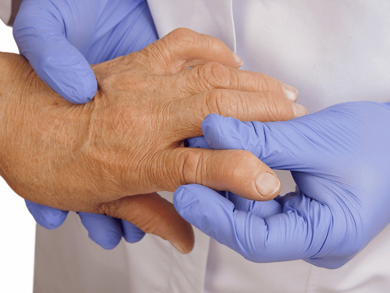 il medico esamina la mano per il dolore alle articolazioni delle dita